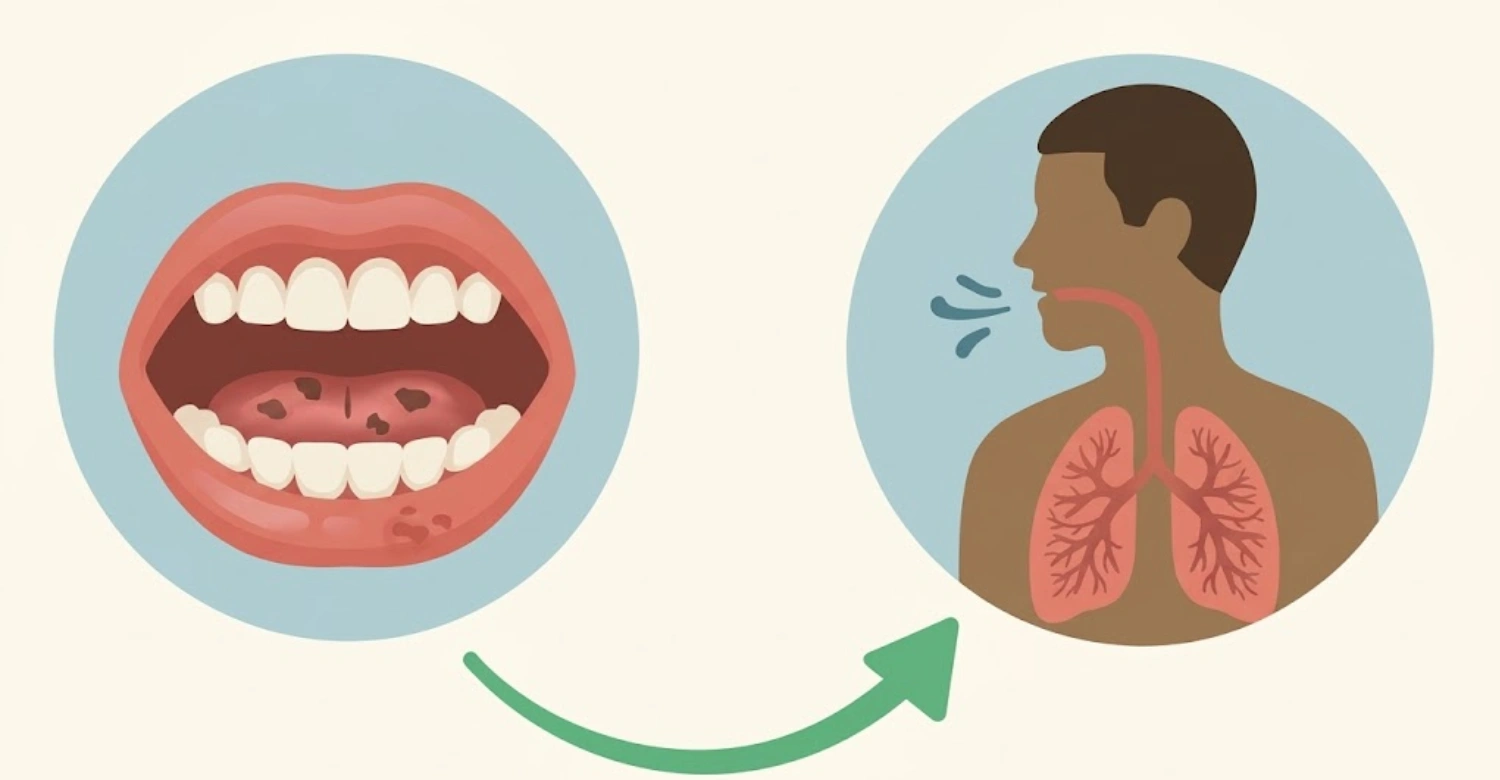 Bronchitis and Tooth Loss1